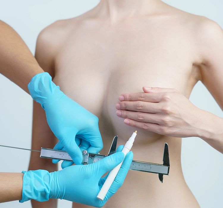 Breast Augmentation – Evo Klinik